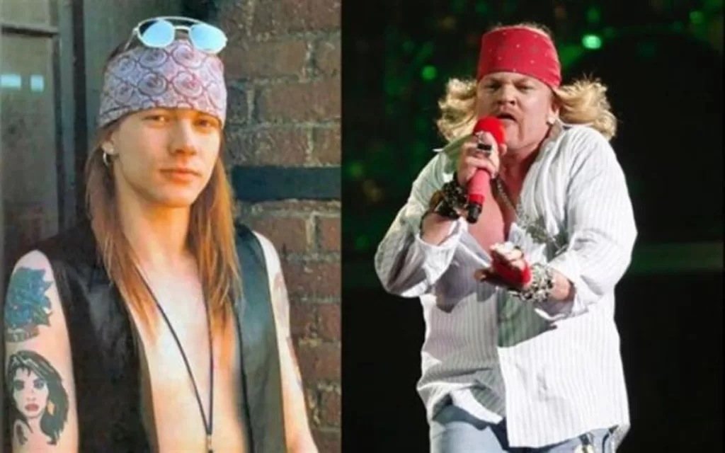 Axl Rose jóven y viejo