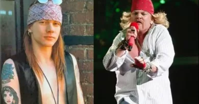 Axl Rose jóven y viejo