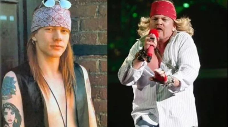 Axl Rose jóven y viejo